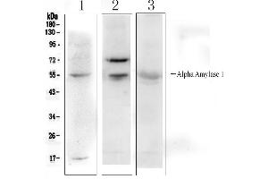 Western blot analysis of Alpha Amylase 1 using anti- Alpha Amylase 1 antibody . (AMY1A 抗体  (N-Term))