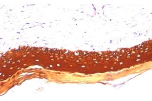 Formalin-fixed, paraffin-embedded human Skin stained with Cytokeratin, LMW Monoclonal Antibody (KRTL/1077). (Keratin 77 抗体)