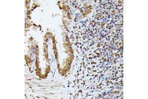 Immunohistochemistry of paraffin-embedded rat lung using HNRNPL antibody (ABIN6128048, ABIN6141915, ABIN6141917 and ABIN6216076) at dilution of 1:100 (40x lens). (HNRNPL 抗体  (AA 282-589))