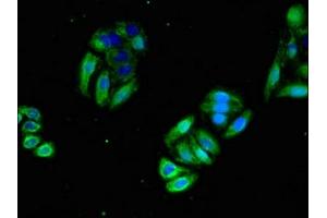 Immunofluorescent analysis of HepG2 cells using ABIN7154637 at dilution of 1:100 and Alexa Fluor 488-congugated AffiniPure Goat Anti-Rabbit IgG(H+L) (GTPase NRas 抗体  (AA 1-186))