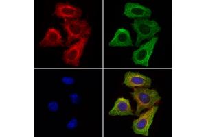 ABIN7094894 and ABIN7098947 staining Hela cells by IF/ICC.