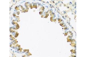 Immunohistochemistry of paraffin-embedded Mouse lung using S100A7 Polyclonal Antibody at dilution of 1:100 (40x lens). (S100A7 抗体)