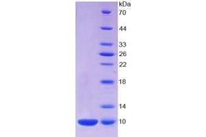 SDS-PAGE analysis of Human S100A7 Protein. (S100A7 蛋白)