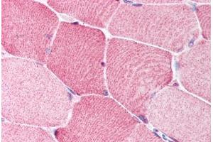 Human Skeletal Muscle (formalin-fixed, paraffin-embedded) stained with BRCC3 antibody ABIN213911 at 5 ug/ml followed by biotinylated goat anti-rabbit IgG secondary antibody ABIN481713, alkaline phosphatase-streptavidin and chromogen. (BRCC3 抗体  (N-Term))
