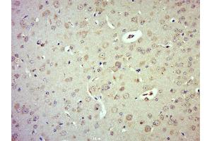 Immunohistochemistry (Paraffin-embedded Sections) (IHC (p)) image for anti-LATS, Large Tumor Suppressor, Homolog 1 (Drosophila) (LATS1) (pThr1079) antibody (ABIN872292)