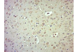 Paraformaldehyde-fixed, paraffin embedded mouse brain; Antigen retrieval by boiling in sodium citrate buffer (pH6.