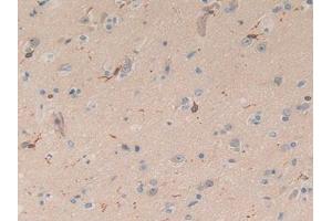 IHC-P analysis of Human Brain Tissue, with DAB staining. (Coronin 1a 抗体  (AA 7-204))