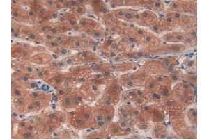 Detection of PYGL in Human Liver Tissue using Polyclonal Antibody to Glycogen Phosphorylase, Liver (PYGL) (PYGL 抗体  (AA 370-538))