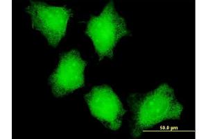 Immunofluorescence (IF) image for anti-Calcium/calmodulin-Dependent Protein Kinase II alpha (CAMK2A) (AA 305-410) antibody (ABIN513973)