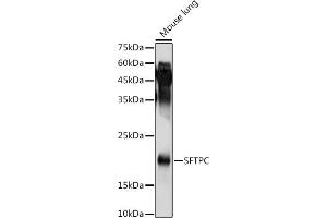 Western Blotting (WB) image for anti-Surfactant Protein C (SFTPC) (AA 1-197) antibody (ABIN3015598)