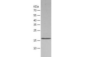 Western Blotting (WB) image for ASF1 Anti-Silencing Function 1 Homolog B (ASF1B) (AA 1-202) protein (His tag) (ABIN7121905) (ASF1B Protein (AA 1-202) (His tag))