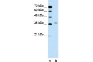 Western Blotting (WB) image for anti-Aminolevulinate Dehydratase (ALAD) antibody (ABIN2462445) (ALAD 抗体)