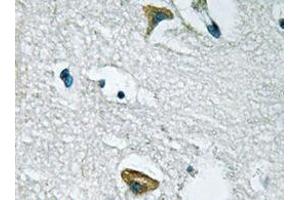 Immunohistochemistry analyzes of JAK3 antibody in paraffin-embedded human brain tissue. (JAK3 抗体)