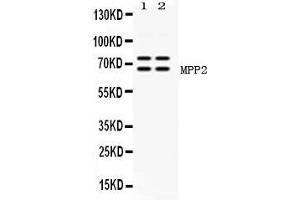 Western blot analysis of MPP2 expression in rat brain extract ( Lane 1) and mouse brain extract ( Lane 2). (MPP2 抗体  (AA 387-576))