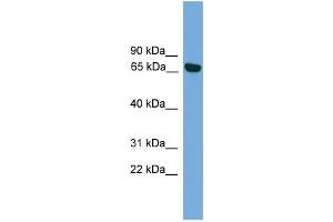 WB Suggested Anti-PRKCI Antibody Titration: 0. (PKC iota 抗体  (Middle Region))