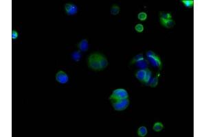 Immunofluorescence (IF) image for anti-Catenin (Cadherin-Associated Protein), beta 1, 88kDa (CTNNB1) (AA 2-781) antibody (ABIN7146984)