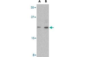 Western blot analysis of CASP6 in MCF-7 cell lysate with CASP6 polyclonal antibody  at (A) 1 and (B) 2 ug/mL . (Caspase 6 抗体  (Internal Region))