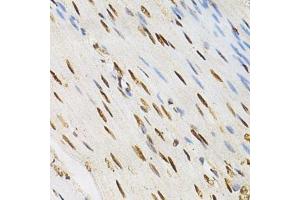 Immunohistochemistry of paraffin-embedded human colonic muscle using KPNA4 Antibody. (KPNA4 抗体  (AA 1-240))