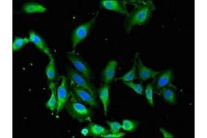 Immunofluorescent analysis of Hela cells using ABIN7159984 at dilution of 1:100 and Alexa Fluor 488-congugated AffiniPure Goat Anti-Rabbit IgG(H+L) (MAPK12 抗体  (AA 314-367))