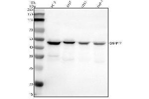 Western blot analysis of SNAP47 using anti-SNAP47 antibody (ABIN7825901).