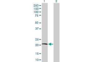 Western Blot analysis of NDUFB10 expression in transfected 293T cell line by NDUFB10 MaxPab polyclonal antibody.