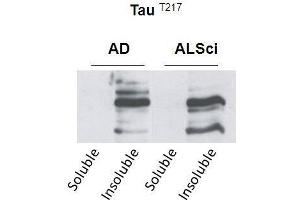 Western blot detection of insoluble phospho-Tau protein using the anti-Tau (Thr-217) antibody in samples isolated from patients with a neurodegenerative disease (Amyotropic lateral sclerosis, ALS or Alzheimer’s disease, AD (tau 抗体  (pThr217))