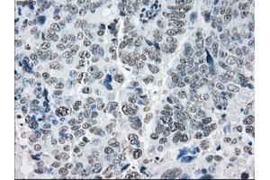Immunohistochemical staining of paraffin-embedded colon tissue using anti-PRKYmouse monoclonal antibody. (PRKY 抗体)