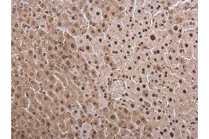 Immunohistochemistry (IHC) image for anti-Proteasome (Prosome, Macropain) Subunit, beta Type, 8 (Large Multifunctional Peptidase 7) (PSMB8) (Center) antibody (ABIN2856915)