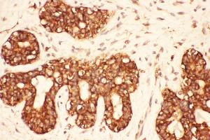 Immunohistochemistry (IHC) image for anti-Proto-oncogene tyrosine-protein kinase Src (Src) (AA 2-368) antibody (ABIN3043441)