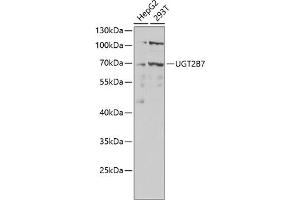 Western blot analysis of extracts of various cell lines, using UGT2B7 antibody (ABIN6132908, ABIN6149903, ABIN6149904 and ABIN6218790) at 1:1000 dilution. (UGT2B7 抗体  (AA 25-351))