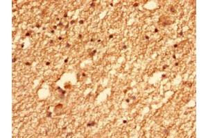 Immunohistochemistry of paraffin-embedded human brain tissue using ABIN7147383 at dilution of 1:100 (CEP126 抗体  (AA 559-670))