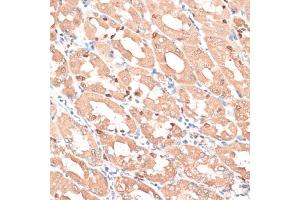 Immunohistochemistry of paraffin-embedded human stomach using HMG antibody (635) at dilution of 1:100 (40x lens). (HMGA1 抗体  (AA 1-100))