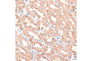 Immunohistochemistry of paraffin-embedded human stomach using HMG antibody (635) at dilution of 1:100 (40x lens). (HMGA1 抗体  (AA 1-100))