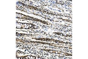 IHC analysis of PTBP1 using anti-PTBP1 antibody (ABIN7599450).