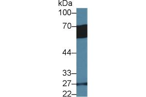 Detection of GP6 in Human Serum using Polyclonal Antibody to Glycoprotein VI (GP6) (GP6 抗体  (AA 86-231))
