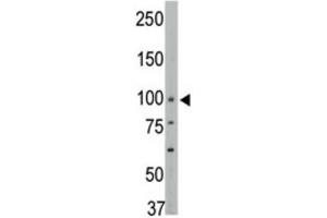 Western Blotting (WB) image for anti-Protein tyrosine Phosphatase, Non-Receptor Type 3 (PTPN3) antibody (ABIN3003754) (PTPN3 抗体)