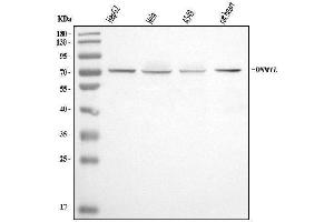 Western blot analysis of DRP1/DNM1L using anti-DRP1/DNM1L antibody (ABIN7601785).