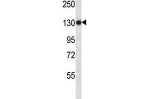Anti-TLR8 antibody western blot analysis in NCI-H460 lysate (TLR8 抗体  (AA 434-463))