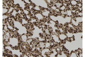 ABIN6277720 at 1/100 staining Rat lung tissue by IHC-P. (TXNIP 抗体  (Internal Region))