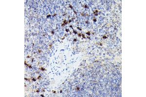 Immunohistochemistry of paraffin-embedded mouse spleen using Cathepsin G Rabbit pAb (ABIN6127687, ABIN6139229, ABIN6139231 and ABIN6221273) at dilution of 1:50 (40x lens).