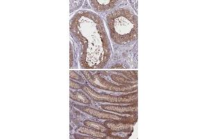 Immunohistochemical staining of human stomach with CORO2A polyclonal antibody  shows cytoplasmic and moderate membranous positivity in glandular cells.