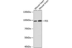 Western blot analysis of extracts of various cell lines using FES Polyclonal Antibody at dilution of 1:1000. (FES 抗体)