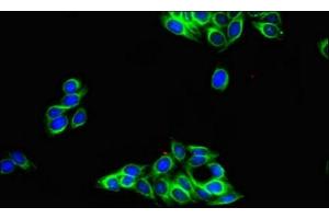 Immunofluorescence (IF) image for anti-Tubulin, alpha 4a (TUBA4A) (AA 20-183) antibody (ABIN7173671)