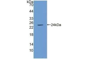 Detection of Recombinant ICAM1, Porcine using Polyclonal Antibody to Intercellular Adhesion Molecule 1 (ICAM1) (ICAM1 抗体  (AA 27-209))