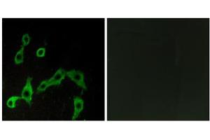 Immunofluorescence analysis of LOVO cells, using ADRA2A antibody. (ADRA2A 抗体  (Internal Region))