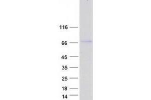 Western Blotting (WB) image for Actin Binding LIM Protein Family, Member 2 (ABLIM2) (Transcript Variant 1) protein (Myc-DYKDDDDK Tag) (ABIN2715705)