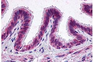 Immunohistochemistry (IHC) image for anti-Prostaglandin E Receptor 2 (Subtype EP2), 53kDa (PTGER2) (N-Term) antibody (ABIN1048568)