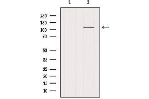 Western blot analysis of extracts from Mouse brain, using Androgen Receptor Antibody. (Androgen Receptor 抗体)