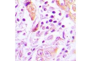 Immunohistochemistry (IHC) image for anti-TSC22 Domain Family, Member 3 (TSC22D3) antibody (ABIN7308446) (TSC22D3 抗体)