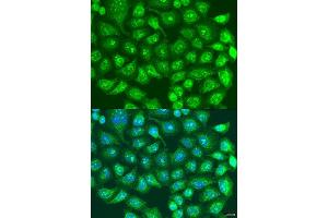Immunofluorescence analysis of U2OS cells using SPICE1 antibody. (SPICE1 抗体  (AA 1-220))